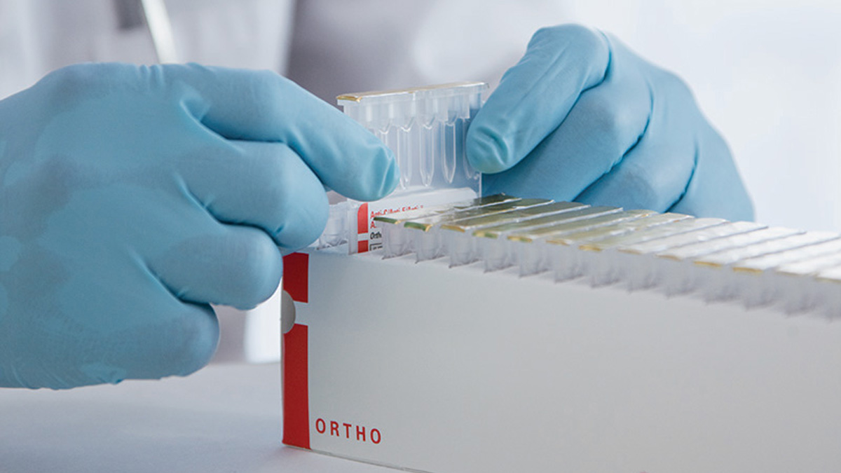 Automating Antibody Titrations